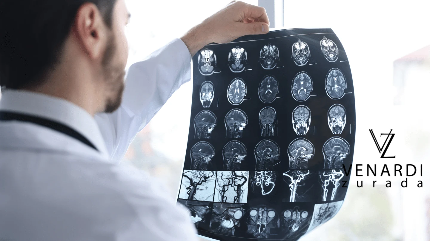 Key Facts About Pediatric TBIs_result